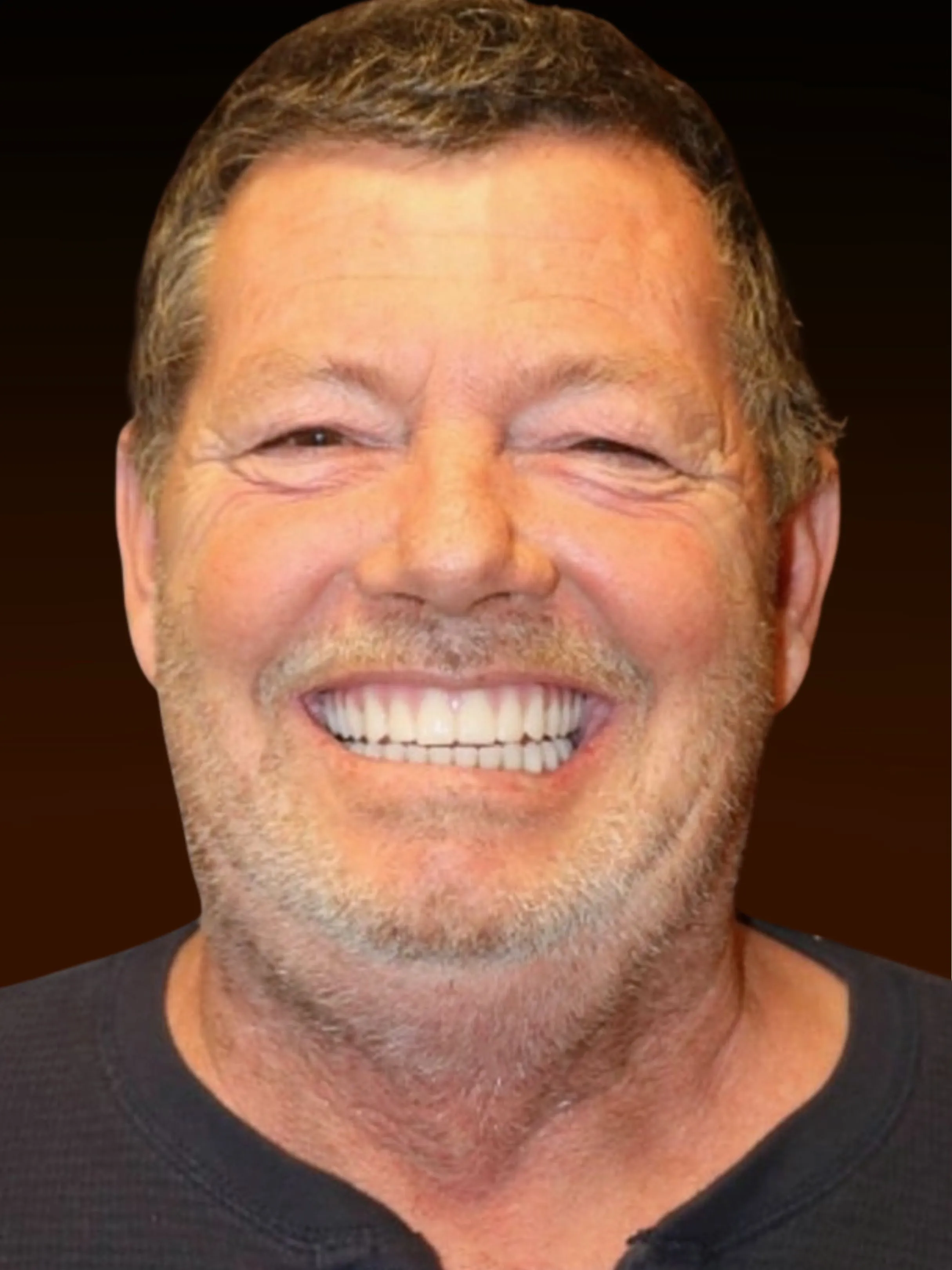 Patient John after full arch dental implant restoration in Northwest Indiana