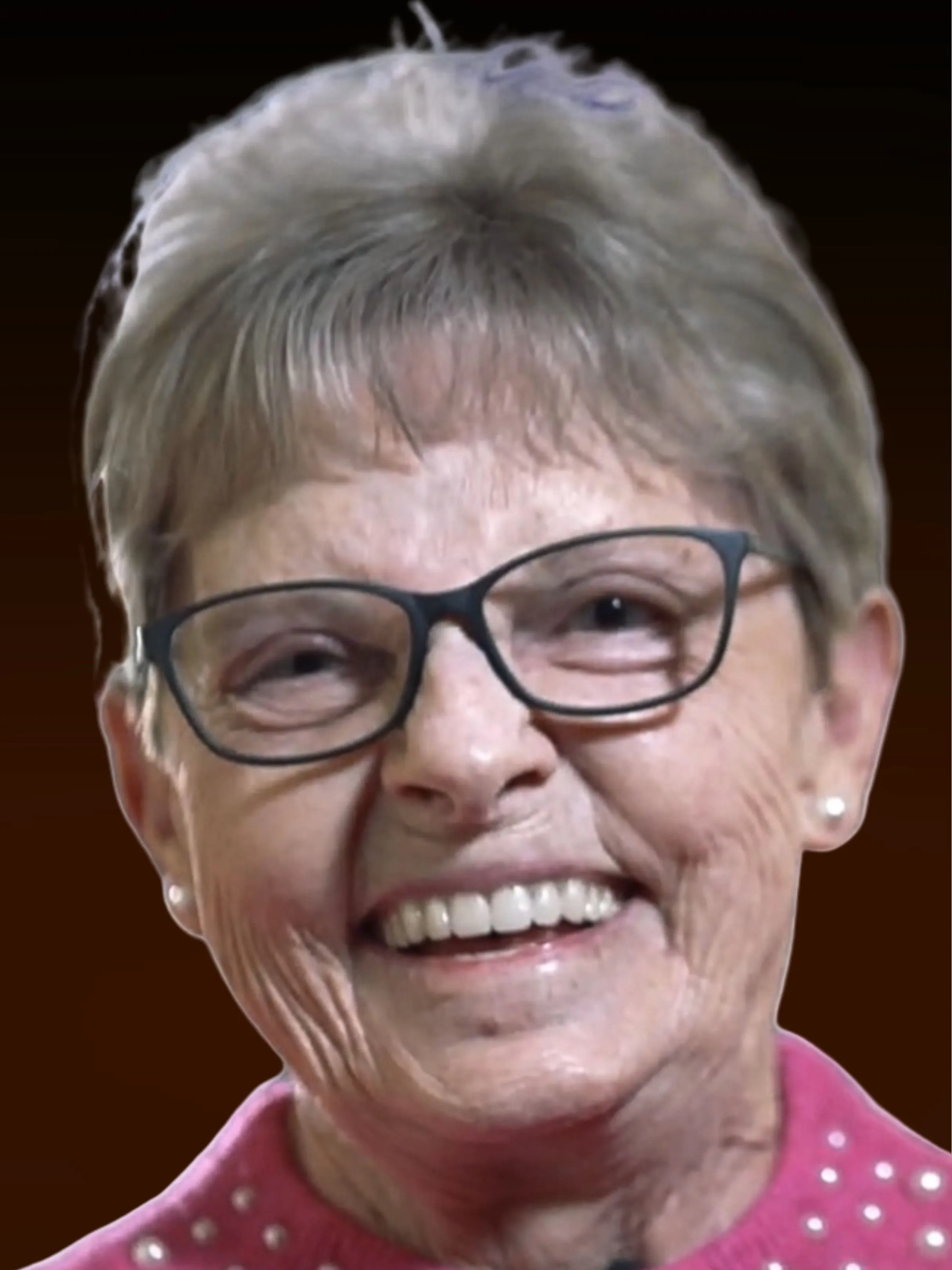 Patient Lois after All-on-4 full arch dental implants — permanent teeth in one day, NW Indiana