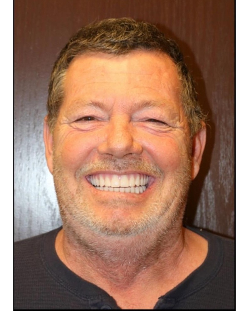 John after