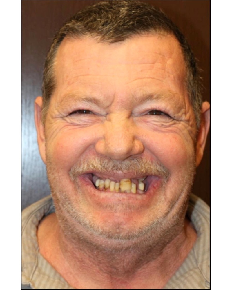 John before
