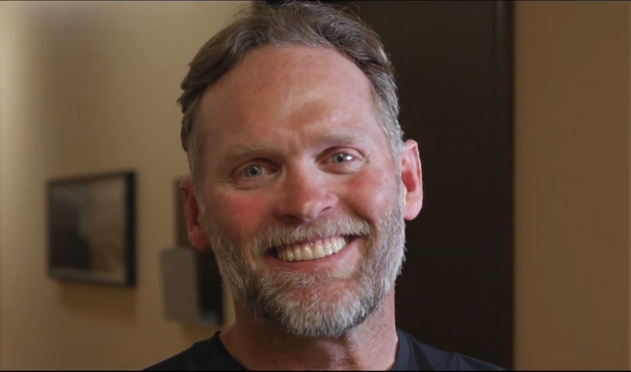 Dental implant transformation
